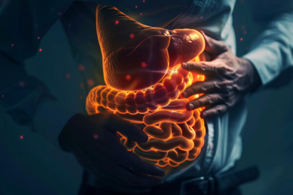 Irritable Bowel Syndrome (IBS): A Common Digestive Condition